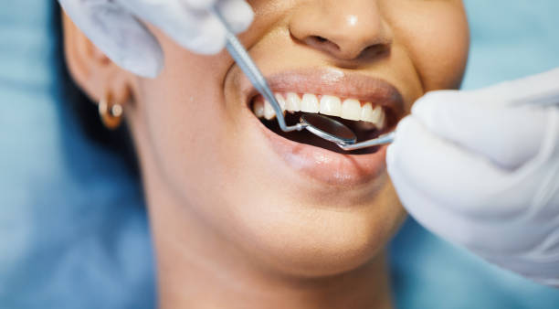 Best Emergency Dental Care for Broken or Chipped Teeth in Sumrall, MS